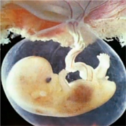 A magzat a terhessg kilencedik hetben