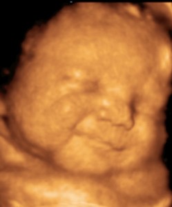 30 hetes 4d ultrahang