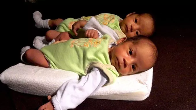 A világ legkorábban született ikrei 22 hetesen jöttek világra - így néznek ki most, 1 évesen