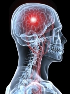 T�bb k�ros �rt�kre is f�ny der�lt - Stroke Nap 2012