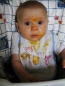 Hozz�t�pl�l�s: nem mindegy, mikor kezdi - allergia megel�z�s �s az els� falatok
