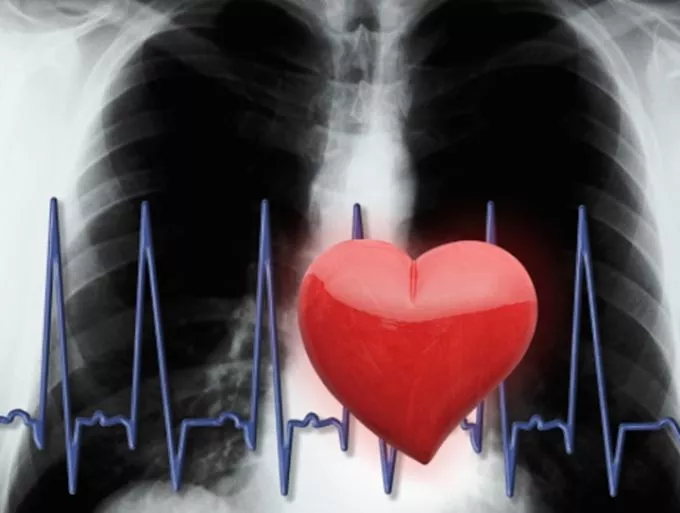 Elindul a szívinfarktus-regiszter
