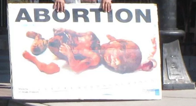 Megrázó szavak, amiket sosem mondhattak ki - ezt éli át a magzat az abortusz közben