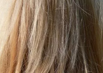 Tizenöt centiméteres hajgombócot operáltak ki egy nő gyomrából