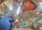 Hajszárítóval próbálta gyógyítani - összeégette kisbabáját egy magyar apa