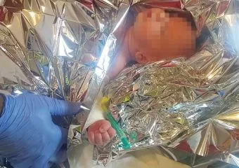 Hajszárítóval próbálta gyógyítani - összeégette kisbabáját egy magyar apa