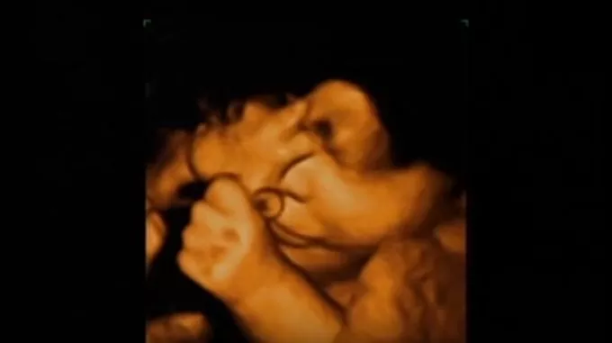 Mit csinál a magzat az anyaméhben? - 4 tündéri ultrahang felvétel