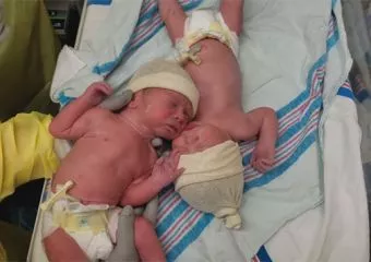 Különleges kapocs az újszülött ikerpár között - videó