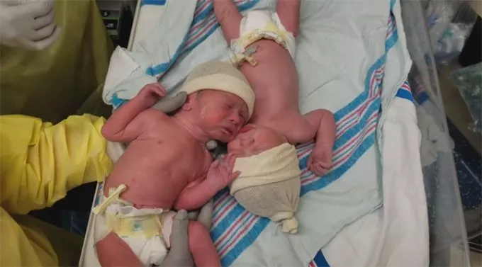 Különleges kapocs az újszülött ikerpár között - videó