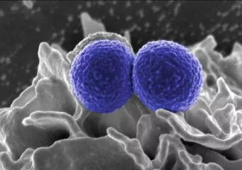 Emberek és baktériumok háborúja - Győzhetünk-e?