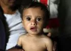 Jemen: kórházban fekvő gyerekek élete forog veszélyben - Te is segíthetsz!