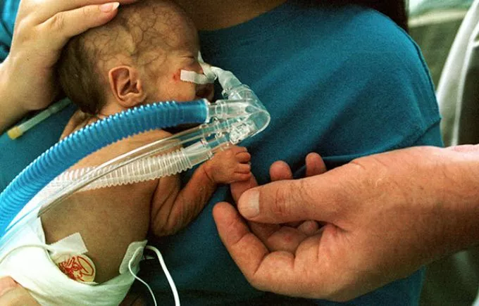 December közepétől nem fogad több babát a koraszülött osztály a Honvéd Kórházban