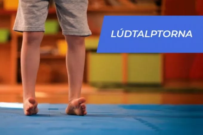 Megfelelő mozgással már gyermekkorban megelőzhető a lúdtalp kialakulása (VIDEÓVAL)