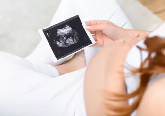 A szívhang meghallgatásához kötik az abortuszt - Pintér Sándor rendelete a napokban lép hatályba