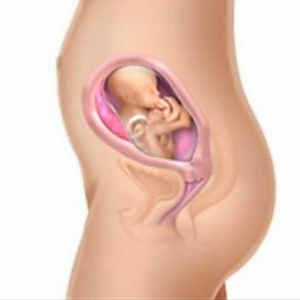 Terhességi fogyás