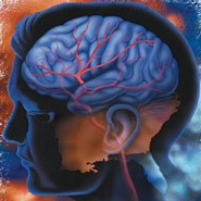 Stroke: szomor tnyek