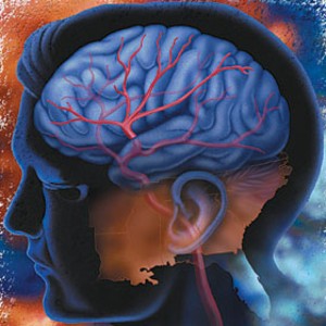 A stroke rehabilitcija az inkontinencia esetn...
