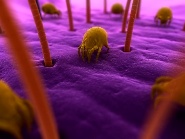 Immunterpia: poratka allergia kezels 3 v alatt