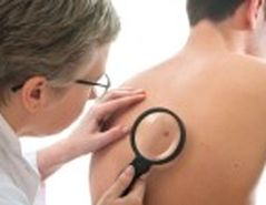 A frfiaknl veszlyesebb a melanoma 