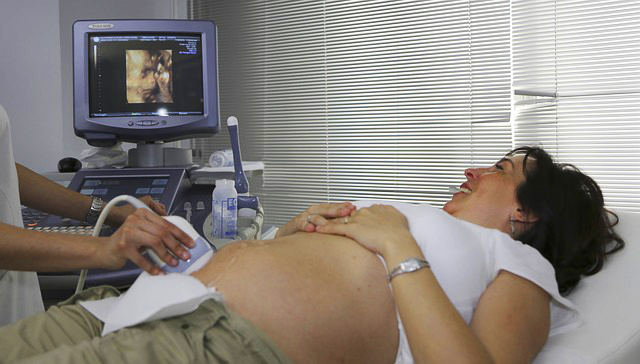 Terhessg alatti ultrahangvizsglat