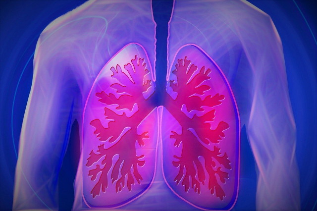 COPD - a tüdő betegsége