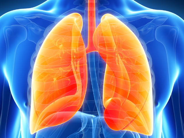 IPF: idiopathiás pulmonális fibrózis