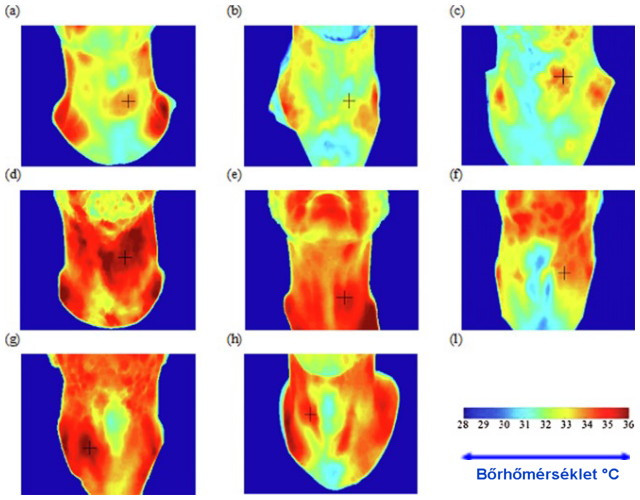 A pajzsmirigygöbök termográfia vizsgálata