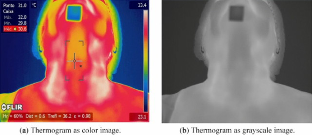 A pajzsmirigy termogram színes és fekete-fehér képe