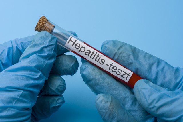 hepatitis (akut s krnikus mjgyullads) vilgnap