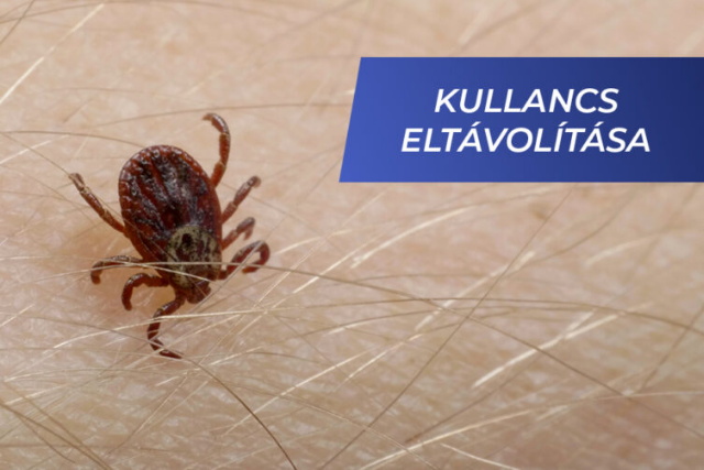 Kullancs eltvoltsa - Semmelweis oktatvidek
