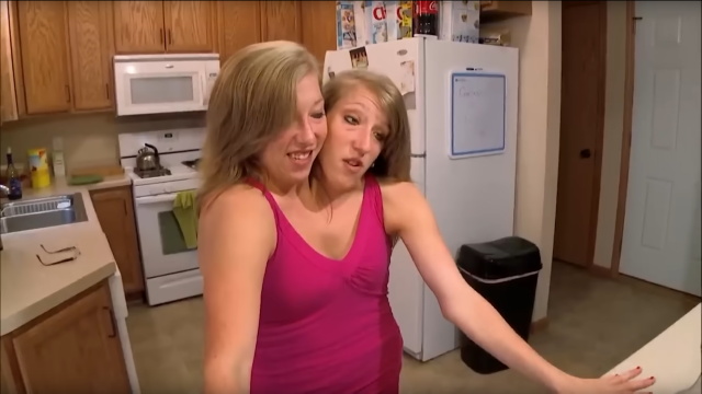 Abby s Brittany Hensel szimi ikrek