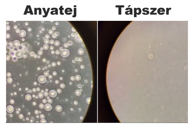 Az anyatej: l, gygyt csoda