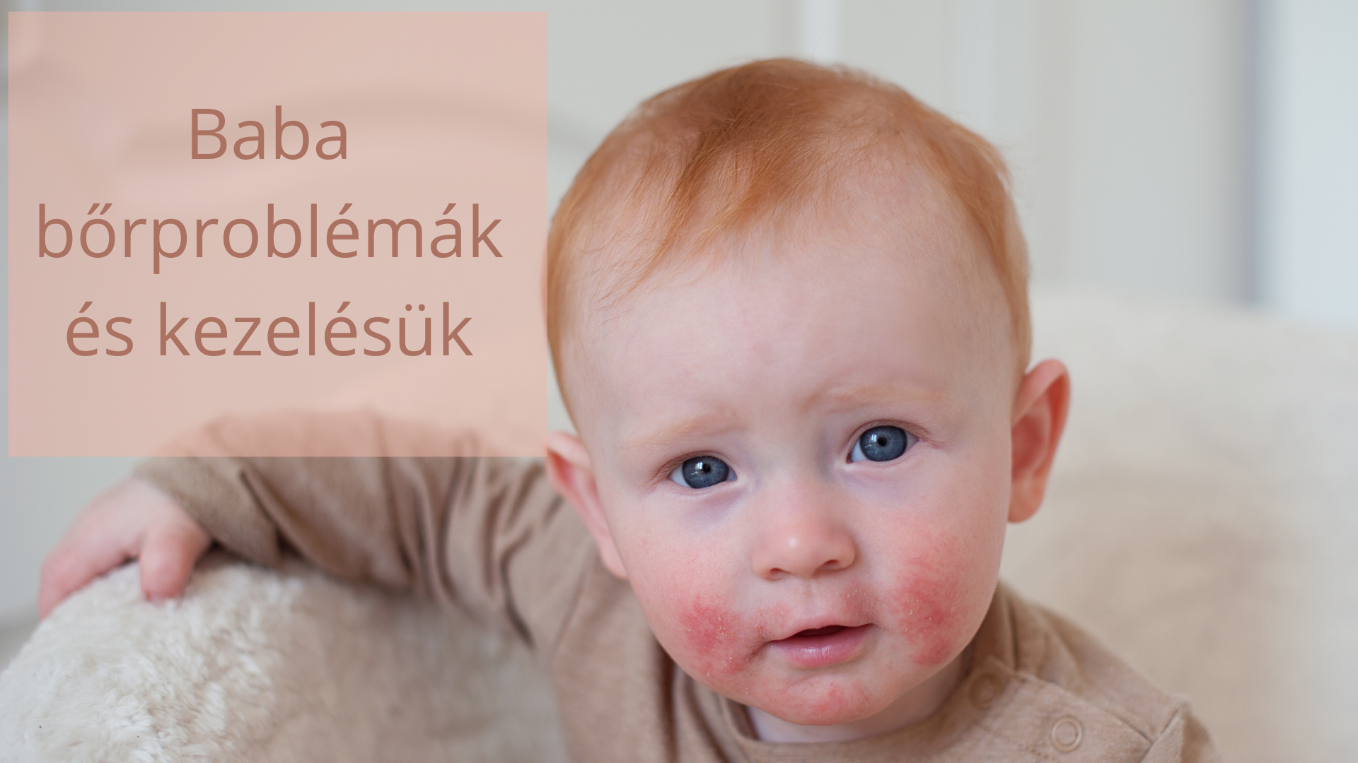 Bőrtünetek babáknál Bőrtünetek babáknál