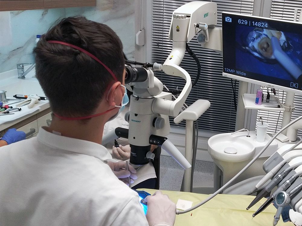 Fogh�z�s vagy gy�k�rkezel�s? Mi�rt jobb a mikroszk�pos gy�k�rkezel�s?