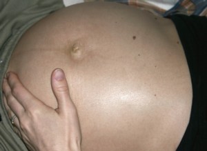 4D Terhességi ultrahang vizsgálat