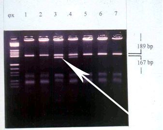 epigenetika_1resz