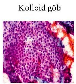 kolloid_gob