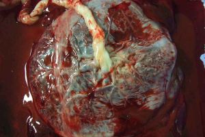 placenta