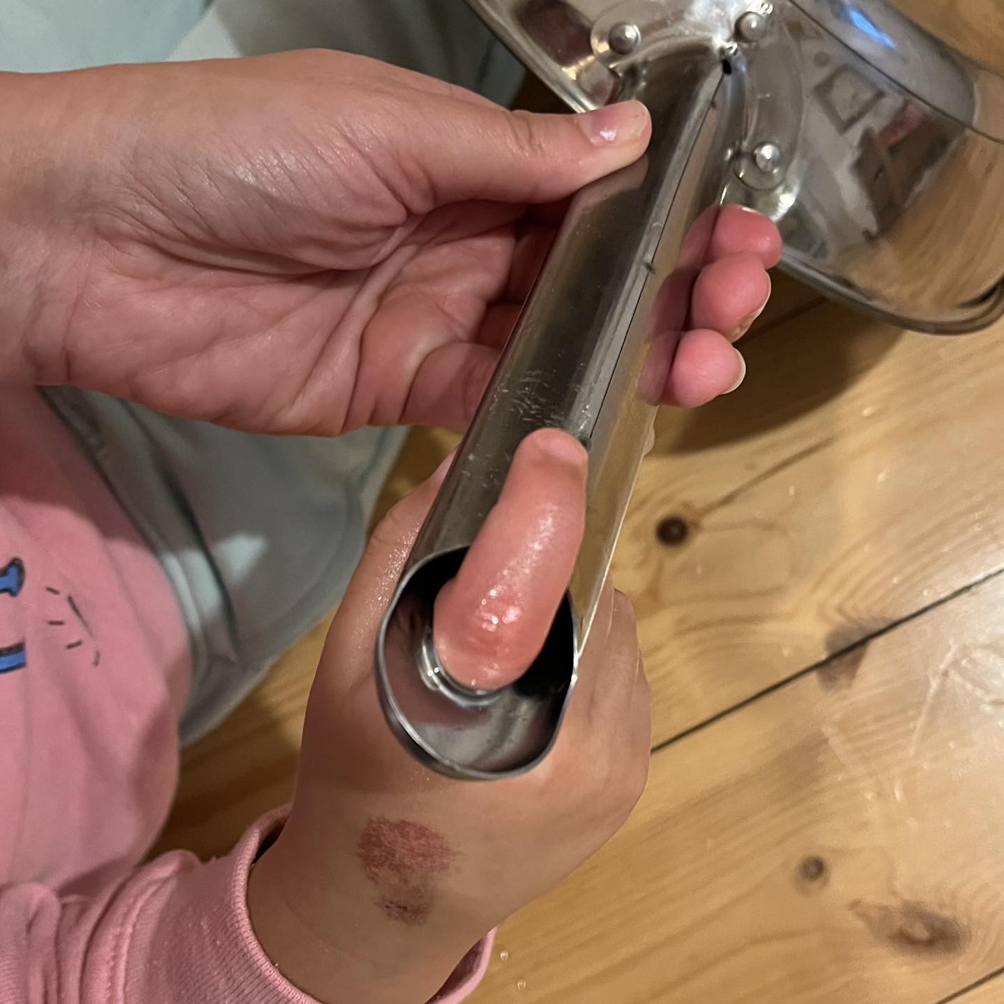 R�m�lom a konyh�ban: beszorult a kisl�ny ujja, a ment�k sem tudt�k kiszabad�tani