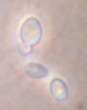 A candida kezelse