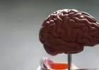 Mennyből a pokolba - diagnózis: agydaganat