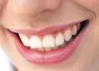 Fehérebb fogak egy óra alatt