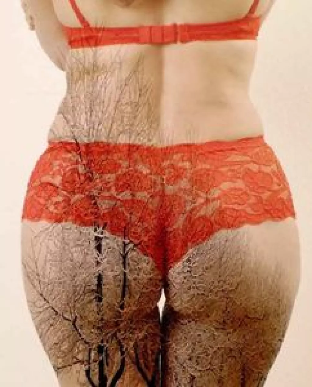 Body contouring: Teljes átalakulás egyetlen műtéttel