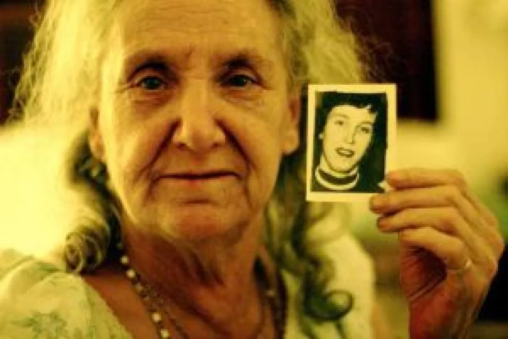 Lézer vs. Botox?