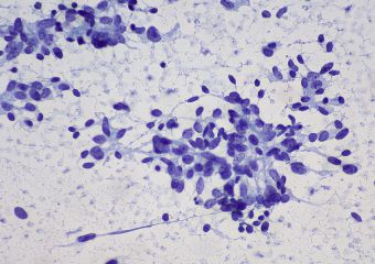 A rákos áttéteket is okozó endotoxinokról indult ismeretterjesztő honlap