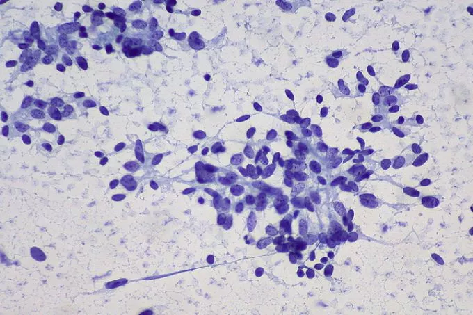 A rákos áttéteket is okozó endotoxinokról indult ismeretterjesztő honlap