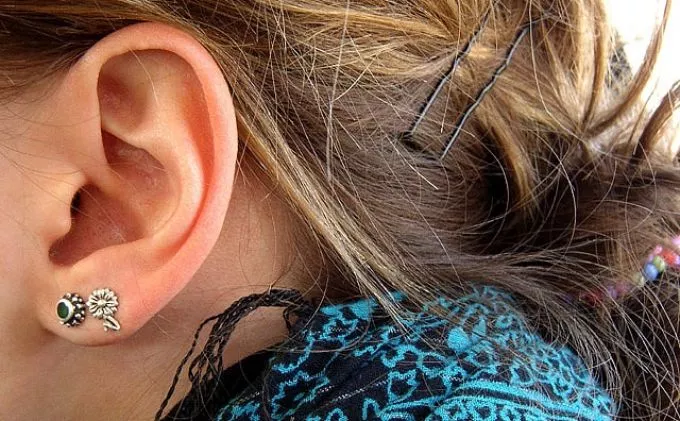 A fülben lévő mitesszerek gyulladást is okozhatnak