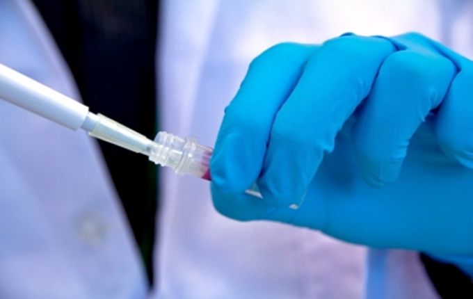 Korai menopauzát okozhat a vegyi anyagokkal való érintkezés Korai menopauzát okozhat a vegyi anyagokkal való érintkezés