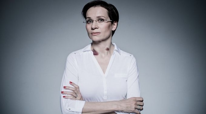 Nekem is fáj! - Ismert nők sebekkel álltak ki a bántalmazottakért Nekem is fáj! - Ismert nők sebekkel álltak ki a bántalmazottakért