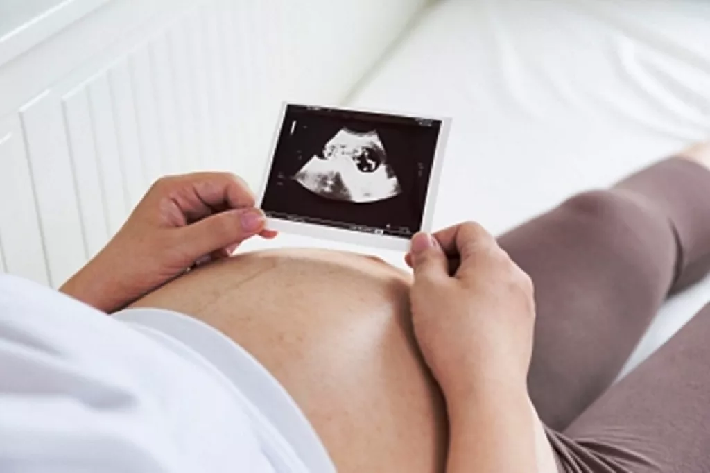 kismama, várandós Segítség, Kismama Lettem! - 3. rész